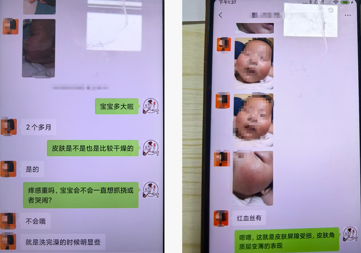 宝妈咨询记录